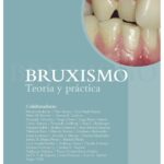 Bruxismo: Teoría y Práctica