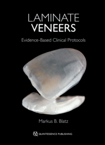 Laminate Veneers Evidence-Based Clinical Protocols