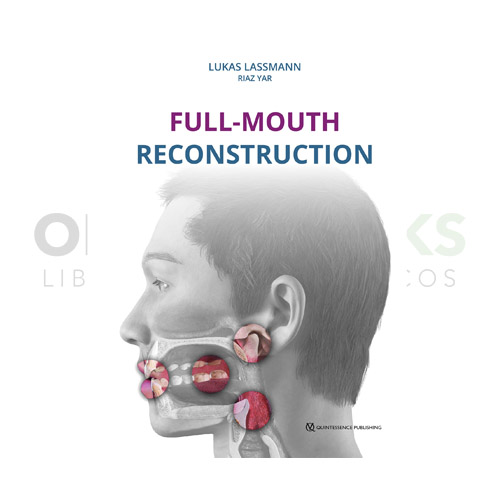Full-Mouth Reconstruction
