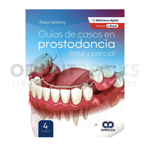 Guías de Casos en Prostodoncia Total y Parcial