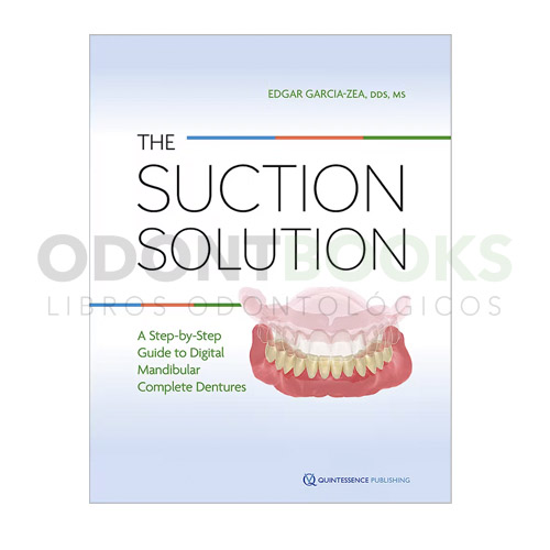 The Suction Solution. A Step-by-Step Guide to Digital Mandibular Complete Dentures
