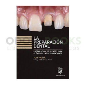 La Preparación Dental. Preparación de Dientes para el Éxito de las Restauraciones